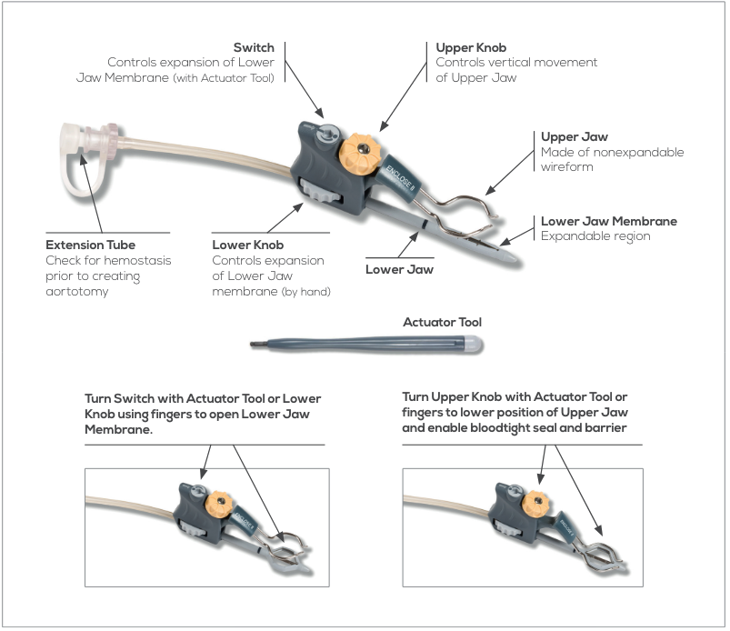 [White Paper] Overcoming the limitations of off-pump CABG - Peters ...